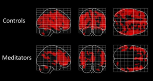 Effects of Meditation on the Brain